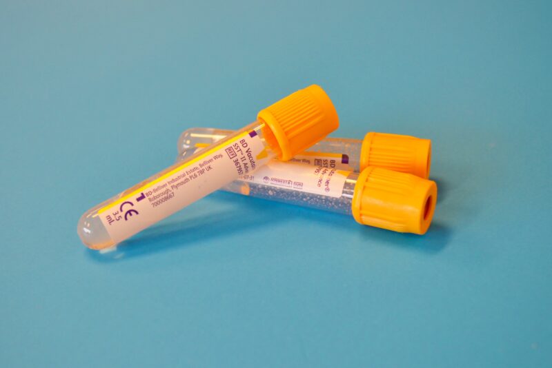Can you catch syphilis without having sex?