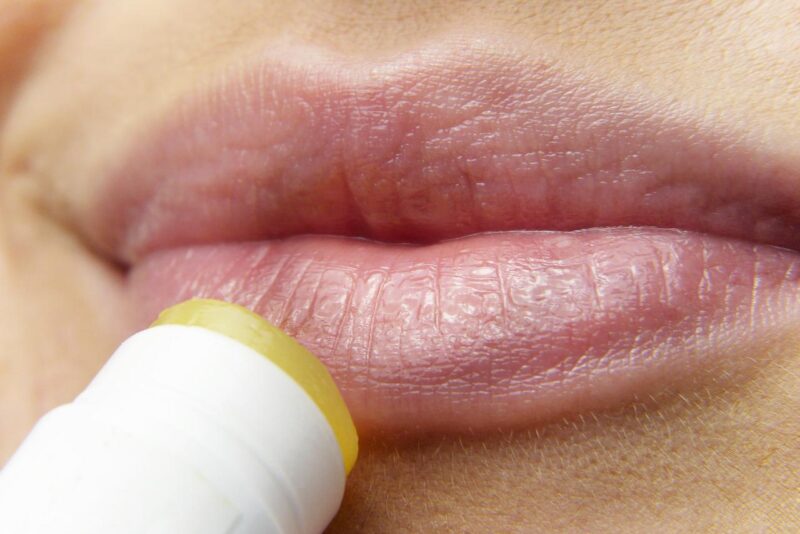STD Testing for Herpes Simplex Virus