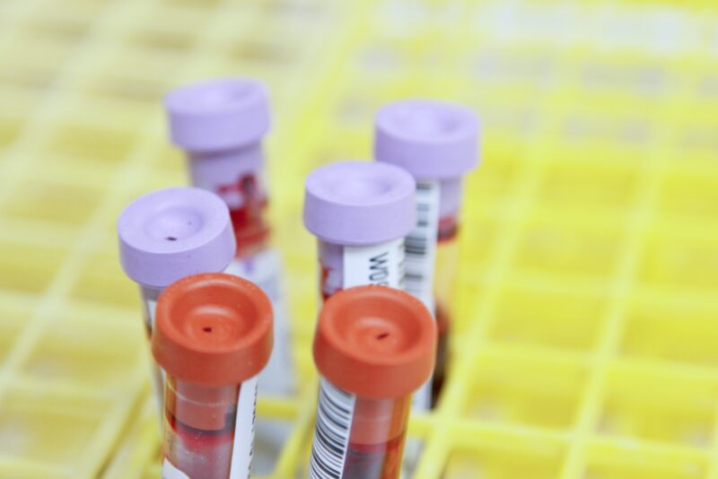 Six blood samples in test tubes